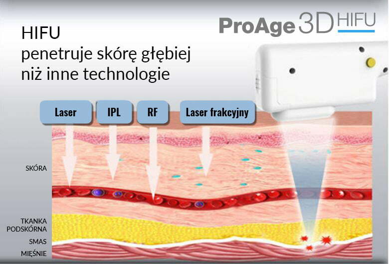 Zabieg HIFU ProAge 3D