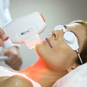 zabieg Alma ClearLift