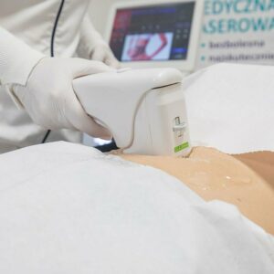 zabieg HIFU 3d 20191207 Beauty Medica W9A0416