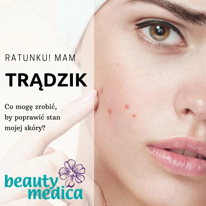 trądzik