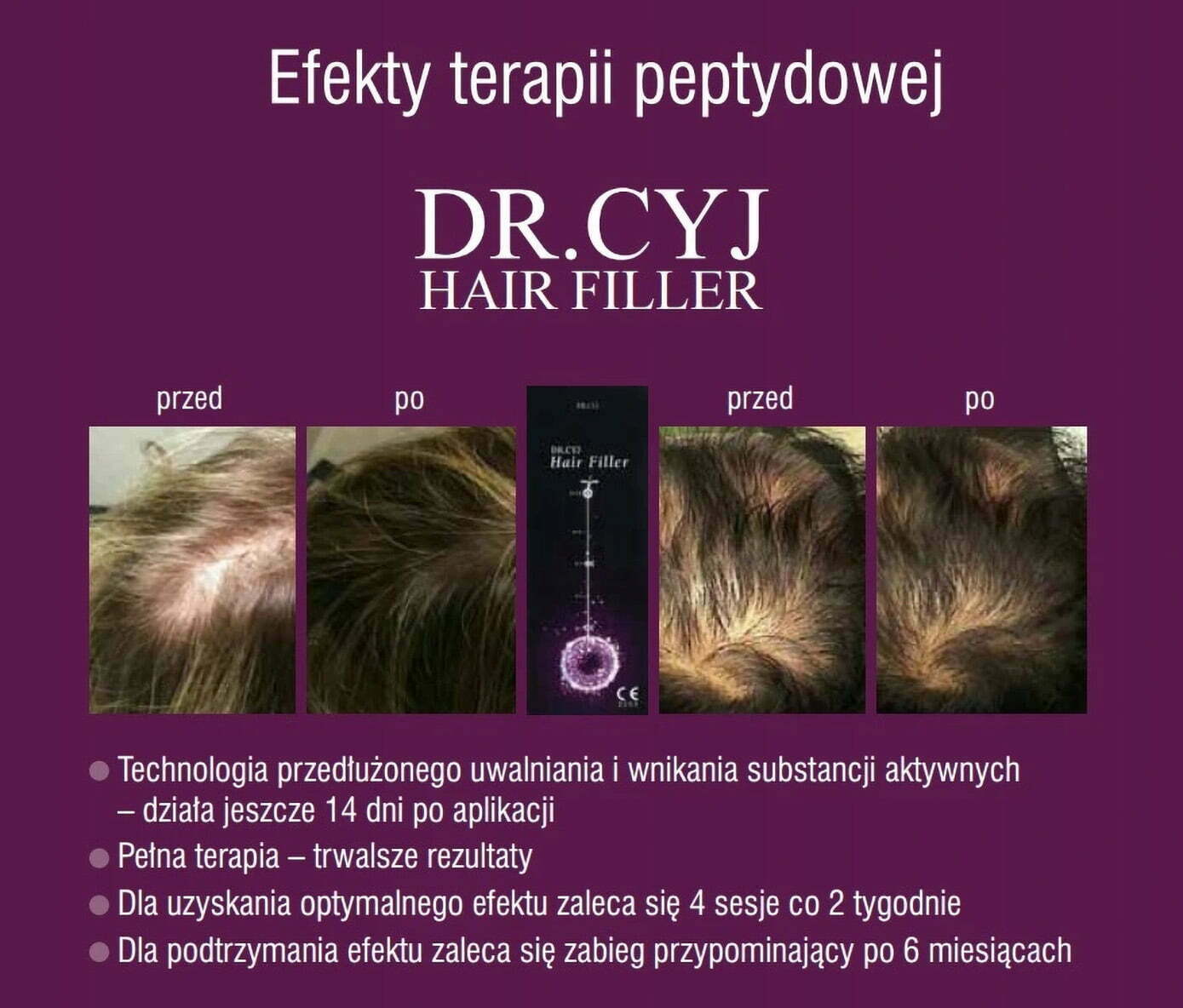 terapia peptydowej Dr Cyj Hair Filler