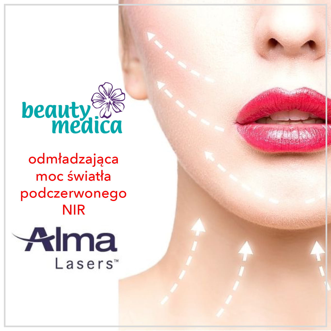 alma lasers NIR