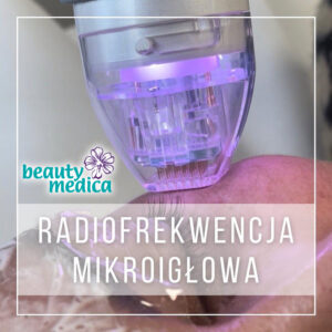 RADIOFREKWENCJA MIKROIGŁOWA