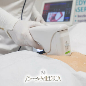 Beauty Medica Zabieg 1