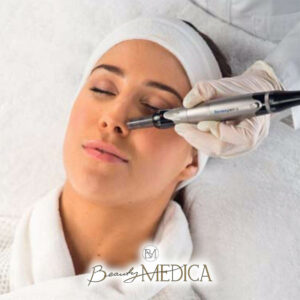 Beauty Medica Zabieg 10