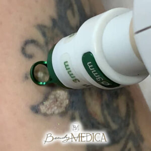 Beauty Medica Zabieg 22