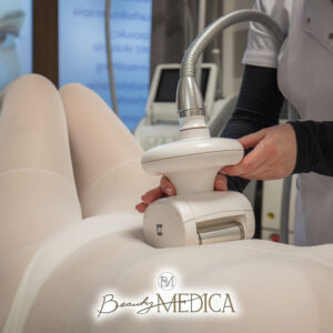 Beauty Medica Zabieg 3