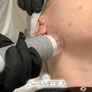 Beauty Medica Zabieg 31
