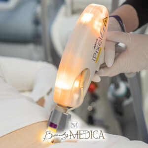 Beauty Medica Zabieg 4