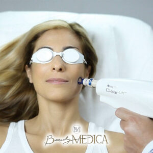 Beauty Medica Zabieg 7