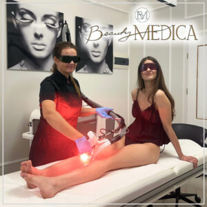 depilacja laserowa